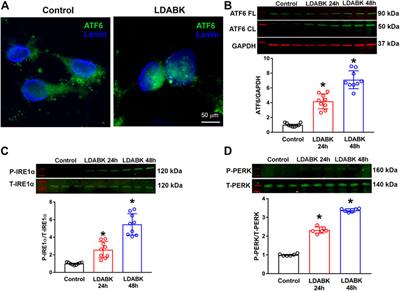 Kinin B1R Activation Induces Endoplasmic Reticulum Stress in Primary Hypothalamic Neurons